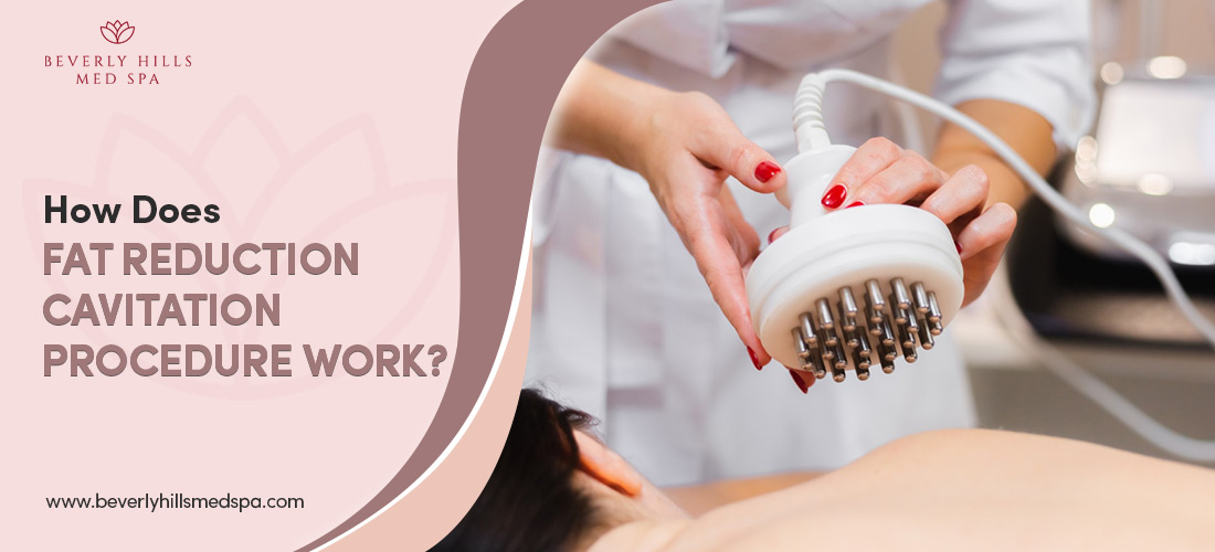 How Does Fat Reduction Cavitation Procedure Work?