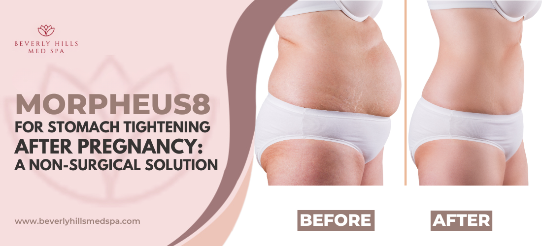 semaglutide slows digestion Semaglutide vs Tirzepatide 💉⚖️, Both are powerful weight-loss injections…, But they are NOT the same., Semaglutide works mainly on GLP-1, ➡️ Helps reduce appetite, ➡️ Slows digestion, ➡️ Makes you semaglutide slows digestion Semaglutide vs Tirzepatide 💉⚖️, Both are powerful weight-loss injections…, But they are NOT the same., Semaglutide works mainly on GLP-1, ➡️ Helps reduce appetite, ➡️ Slows digestion, ➡️ Makes you