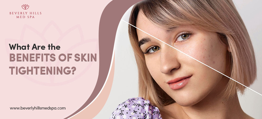What Are the Benefits of Skin Tightening?