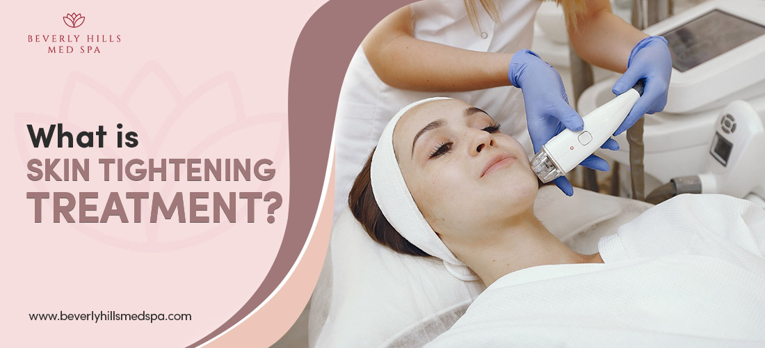 What is skin tightening treatment?